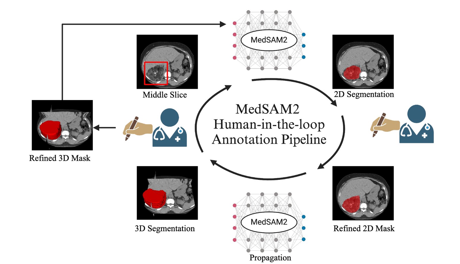 Pipeline de anotación human-in-the-loop de MedSAM2 mostrando segmentación de lesiones hepáticas en MRI, lesiones en CT y ultrasonido cardíaco