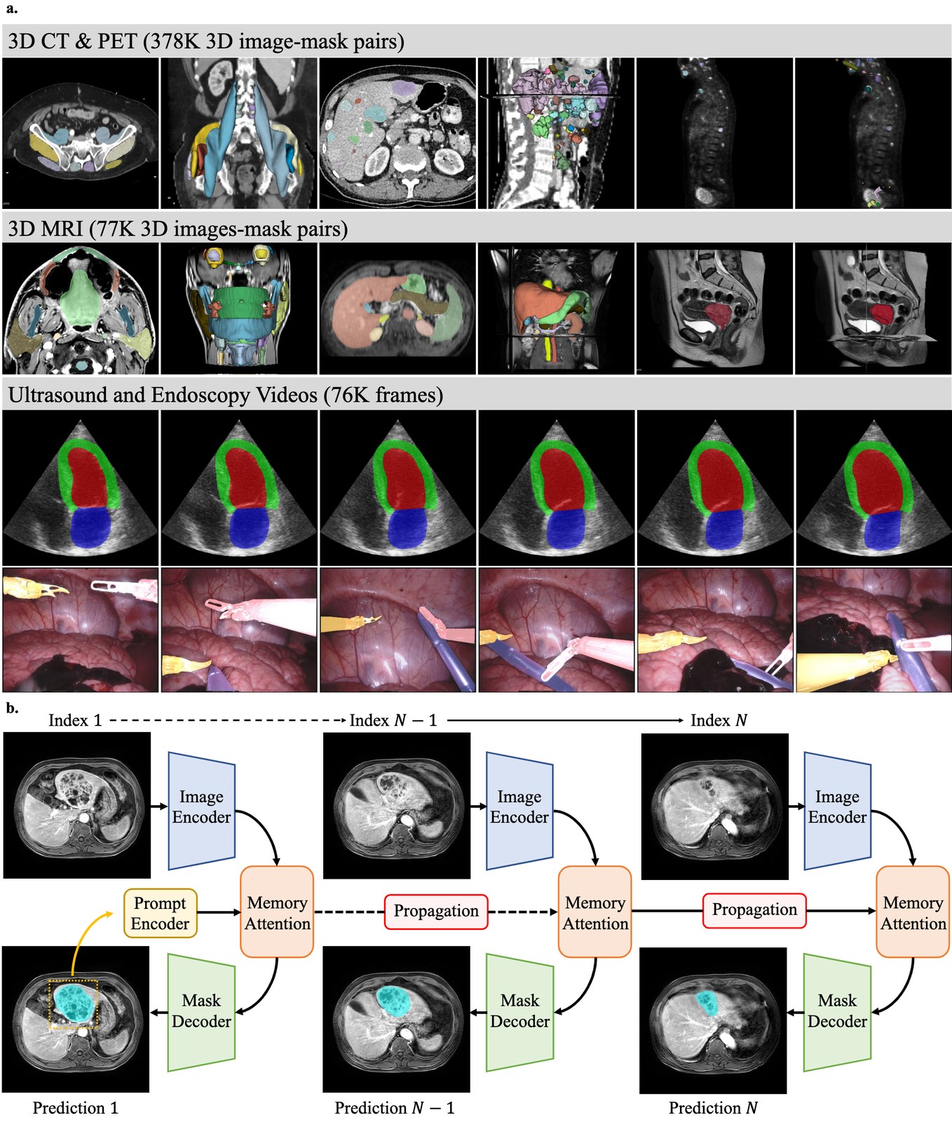 MedSAM2 - Segmentación de imágenes médicas con IA incluyendo CT, MRI, PET y ultrasonido